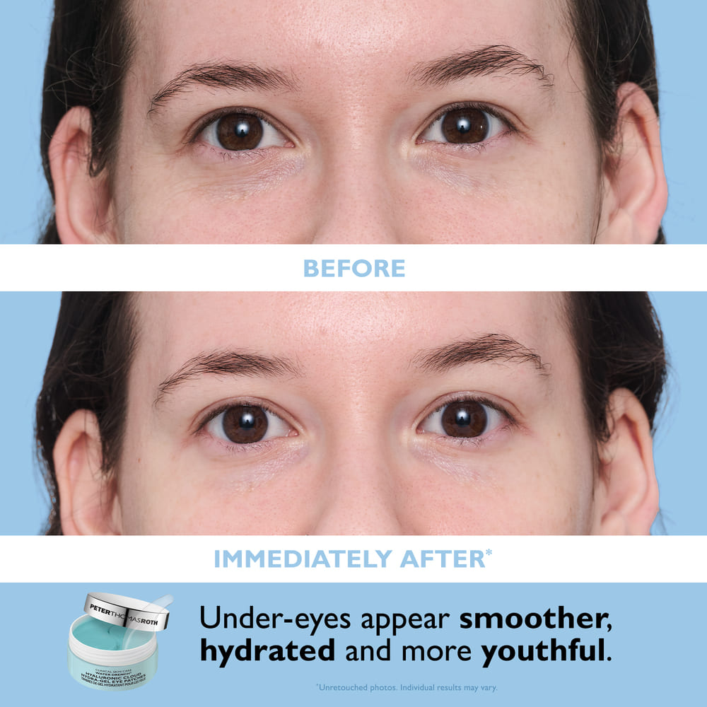 FULL-SIZE WATER DRENCH&reg; ESSENTIALS 2-PIECE MOISTURIZER AND EYE PATCH SET (SET DE CREMA Y PARCHES PARA OJOS HIDRATANTES)